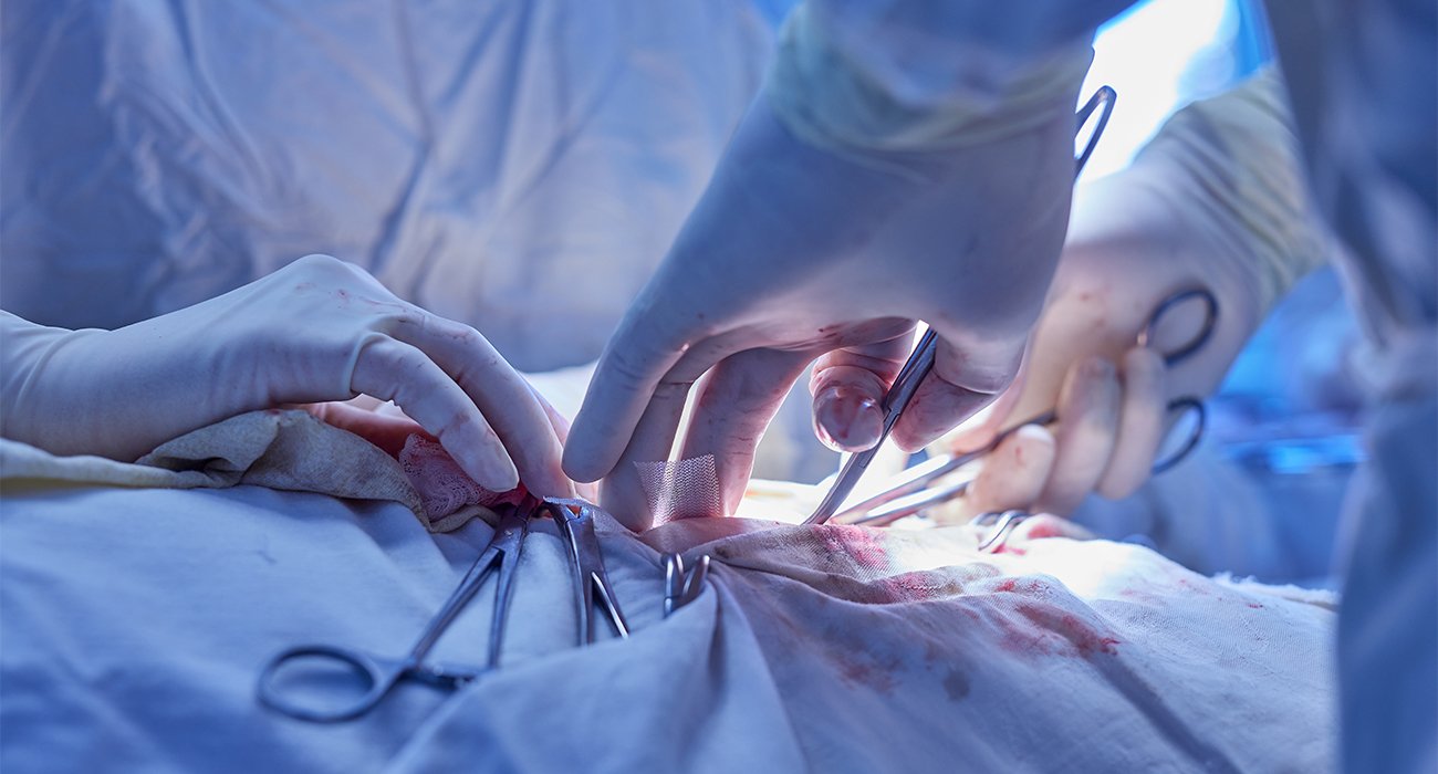 An expert medical team performing a minimally invasive carotid artery stenting procedure in a modern hospital cath lab in Chennai to prevent stroke.